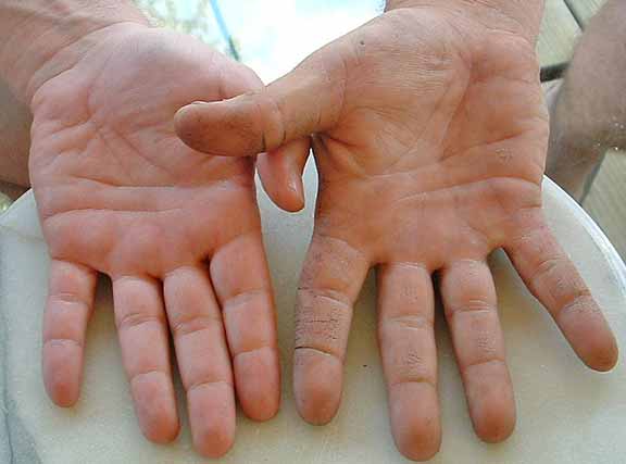 Back of hands